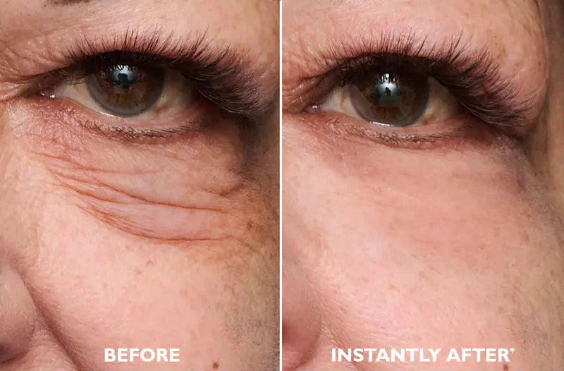 Easy-Wear Eye Tightening Gel – Rapid Lift & Firming