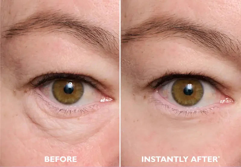 Easy-Wear Eye Tightening Gel – Rapid Lift & Firming